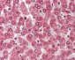 CXADR Antibody (Internal)
